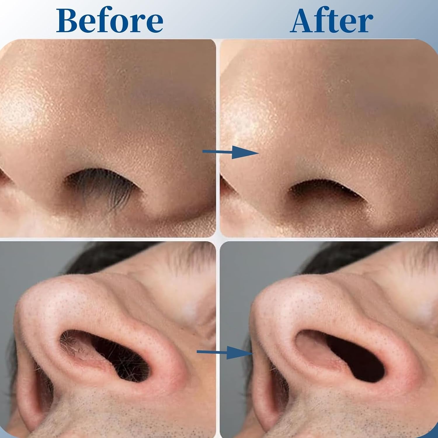 10 PCS 2-In-1 Nose Hair Trimmer, Portable Manual 360 Rotating Nasal Hair Cutter with Ear Picker for Women Men, White Black