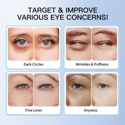 5% Caffeine Eye Cream & Retinol under Eye Cream to Reduce Dark Circles, Puffiness, Wrinkles and Fine Lines, anti Aging under Eye Bags Treatment Serum for Women & Men