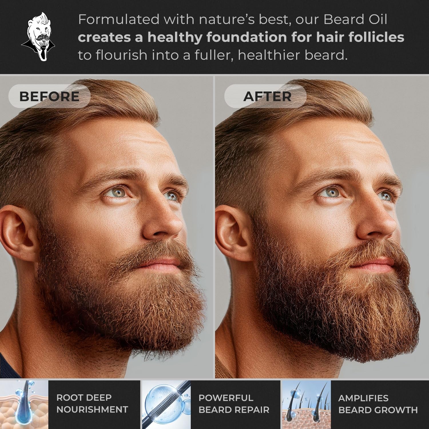 Hypoallergenic All Natural Beard Oil for Men - Unscented, 30Ml Nut Free Made from Seed Beard Oil for Men Growth for Sensitive Skin, Mustache Softener, Mustache Conditioner and Moisturizer
