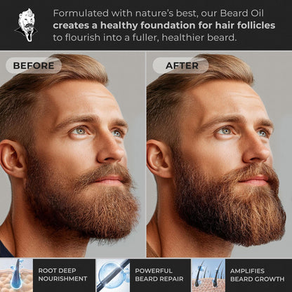 Hypoallergenic All Natural Beard Oil for Men - Unscented, 30Ml Nut Free Made from Seed Beard Oil for Men Growth for Sensitive Skin, Mustache Softener, Mustache Conditioner and Moisturizer